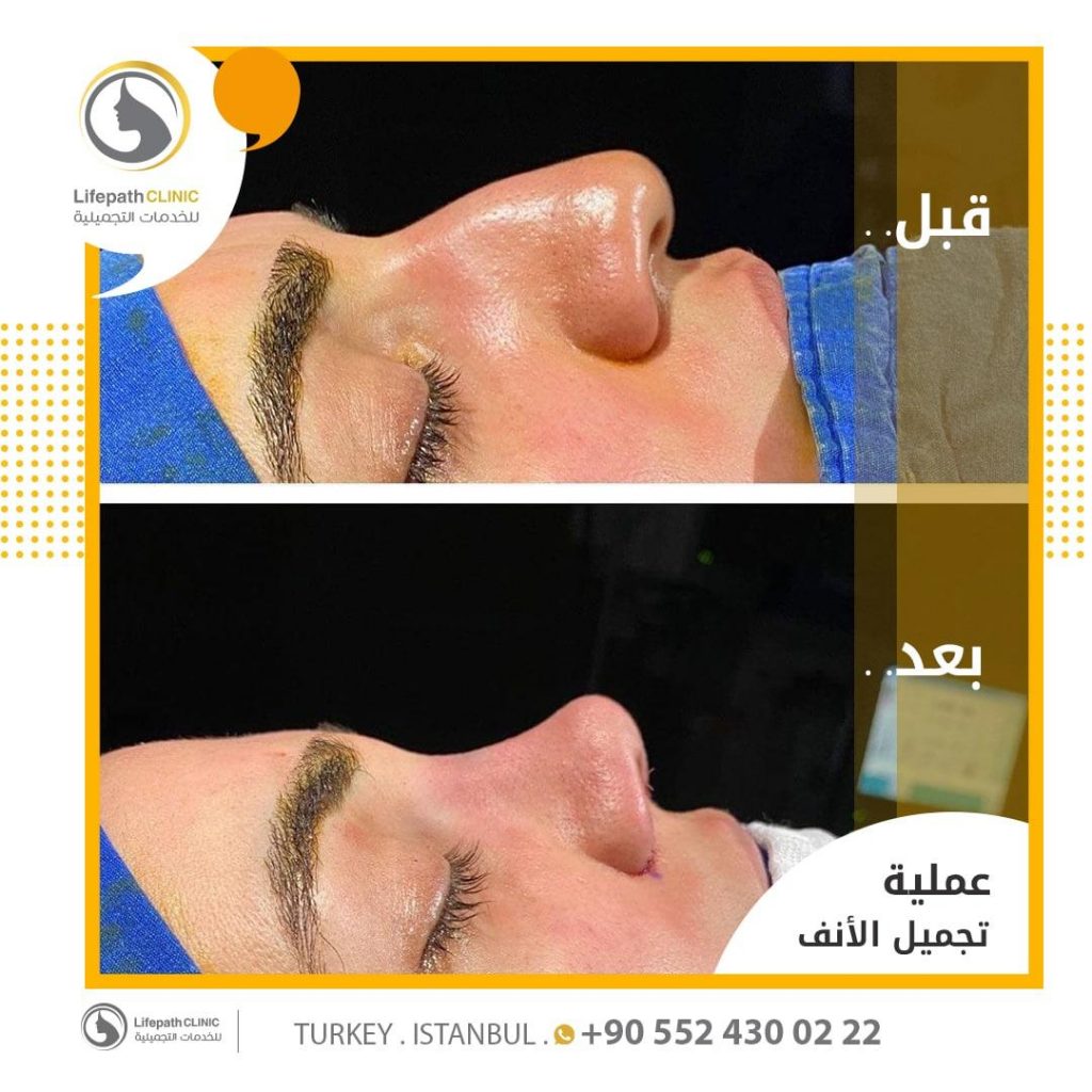 لايف باث كلينك