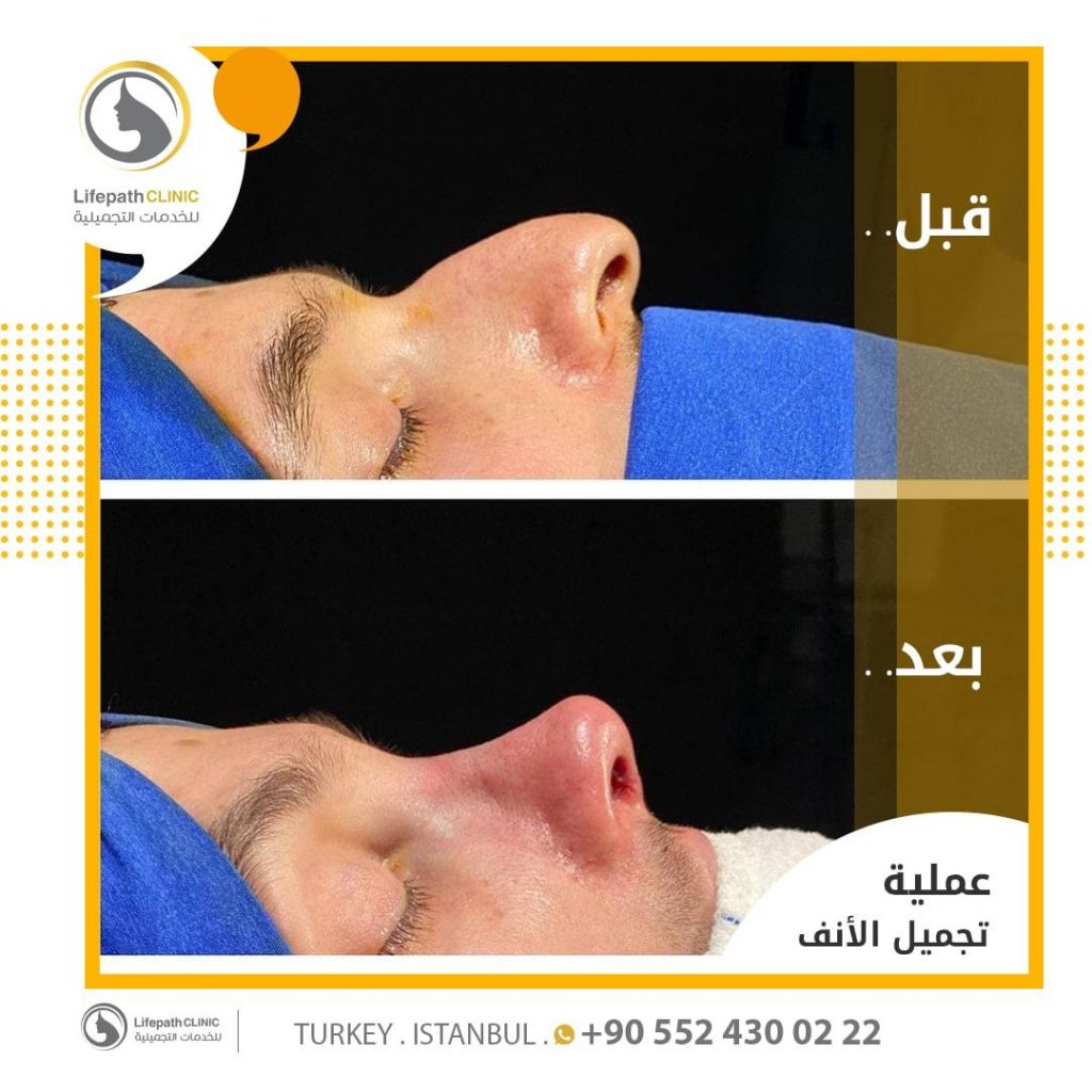 لايف باث كلينك