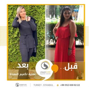جراحة السمنة