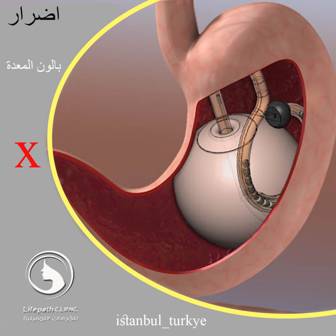 لايف باث كلينك