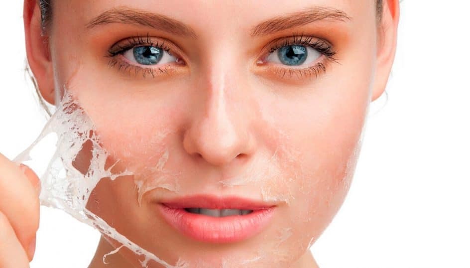 علاجات العناية بالبشرة الشائعة لمقاومة الشيخوخة - التقشير الكيميائي