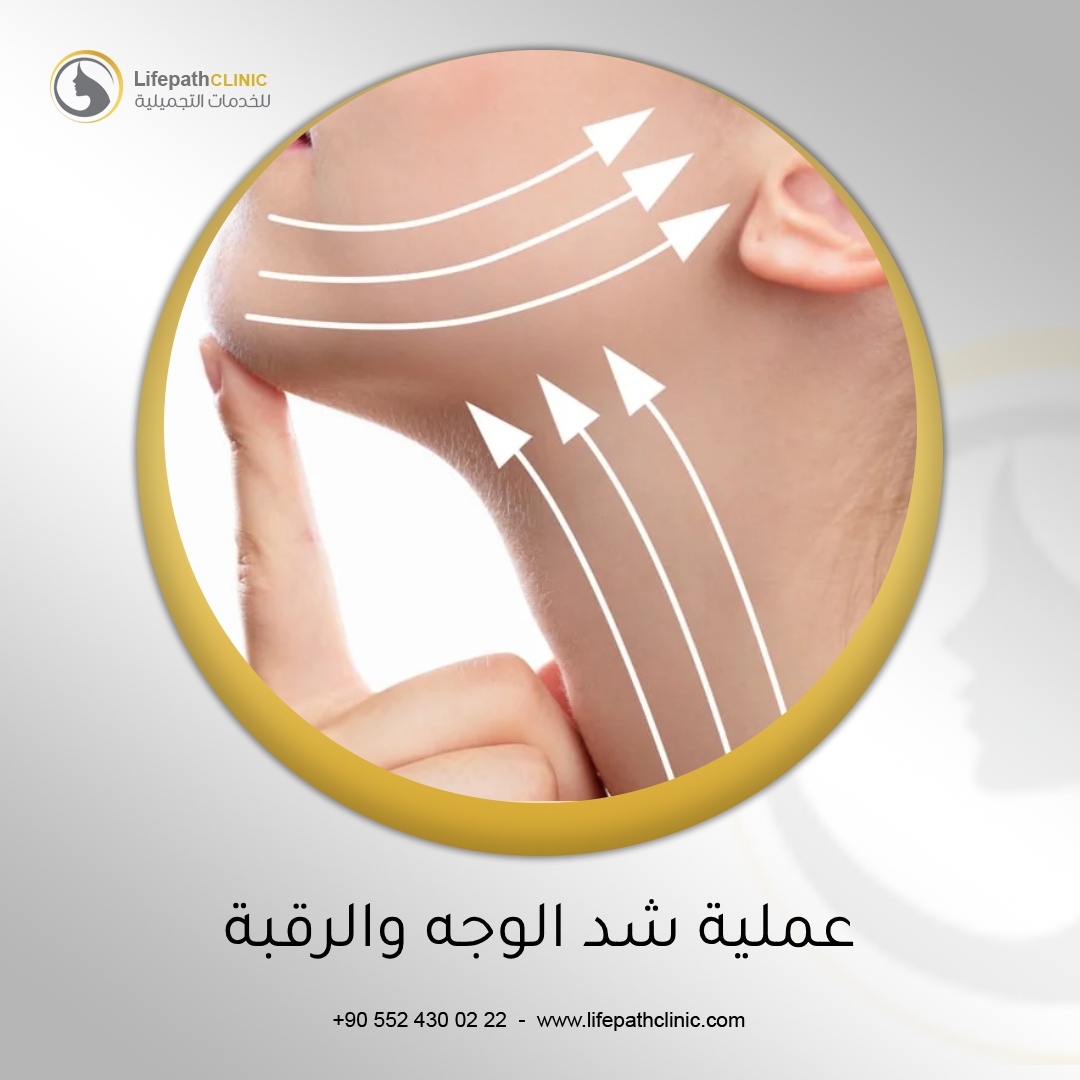عملية شد الوجه والرقبة