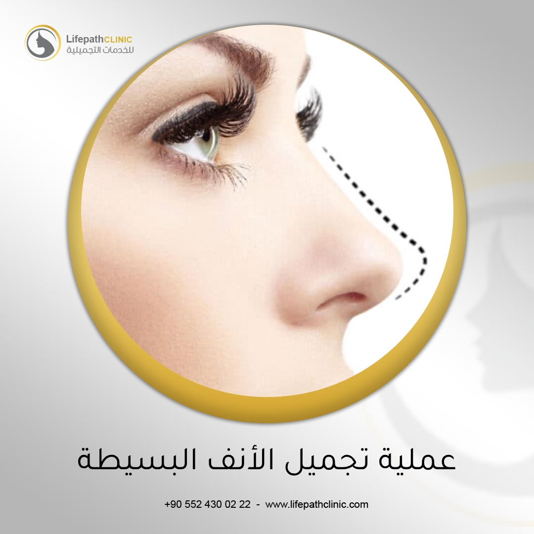 عملية تجميل الأنف البسيطة