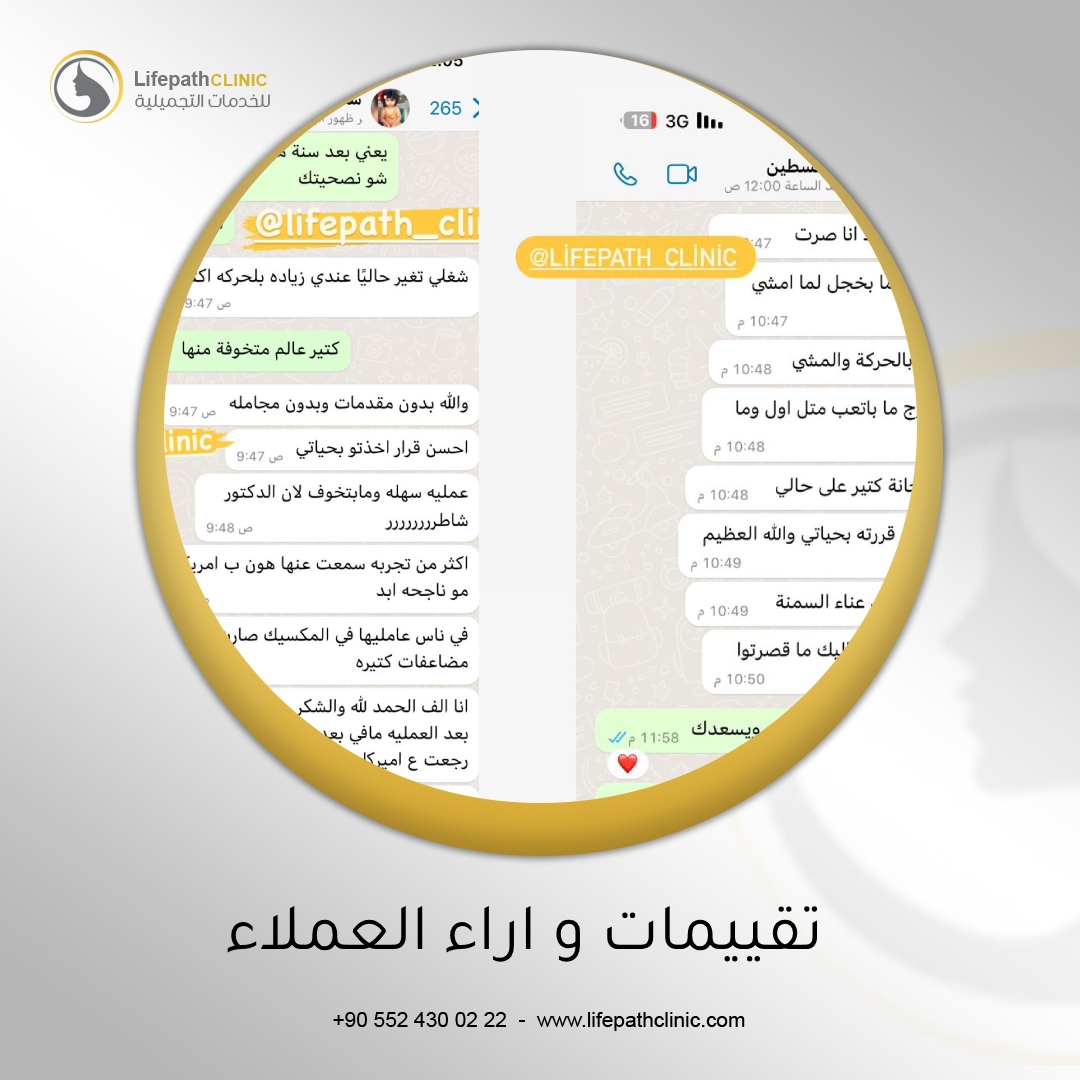 تقييم عمليات تكميم و تحويل مسار المعدة