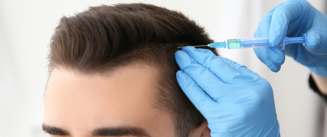 عملية زراعة الشعر