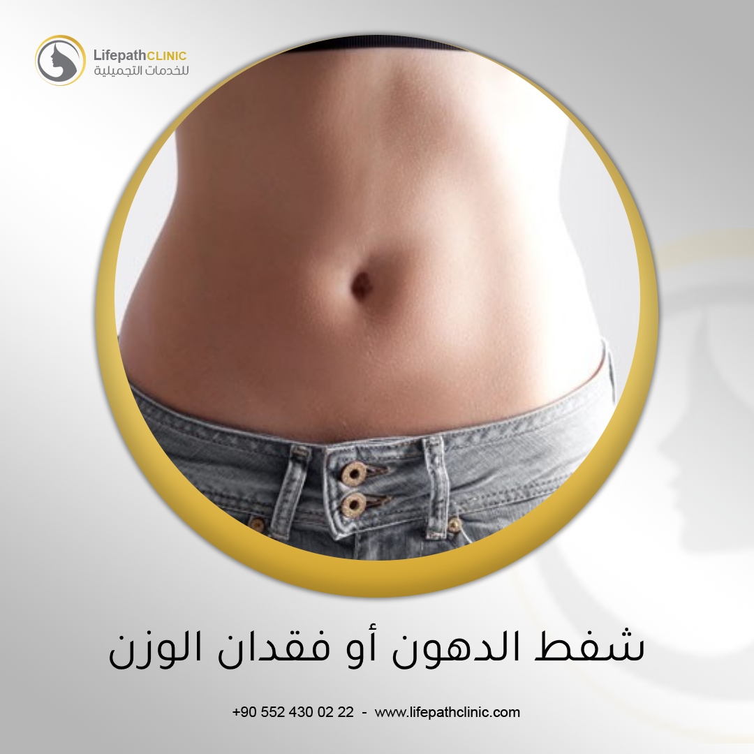 شفط الدهون أو فقدان الوزن - ما الفرق؟