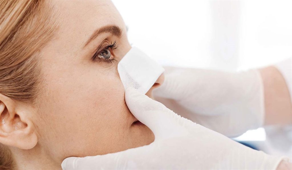 أسئلة وأجوبة حول عملية تجميل الأنف