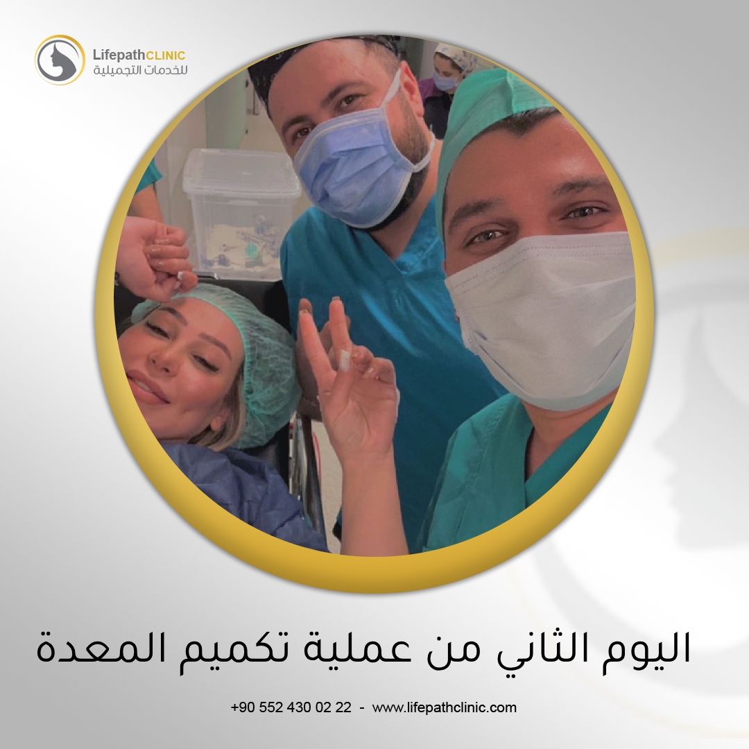 اليوم الثاني من عملية تكميم المعدة