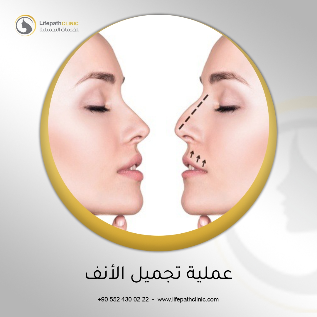 أحدث التطورات في تقنية تجميل الأنف