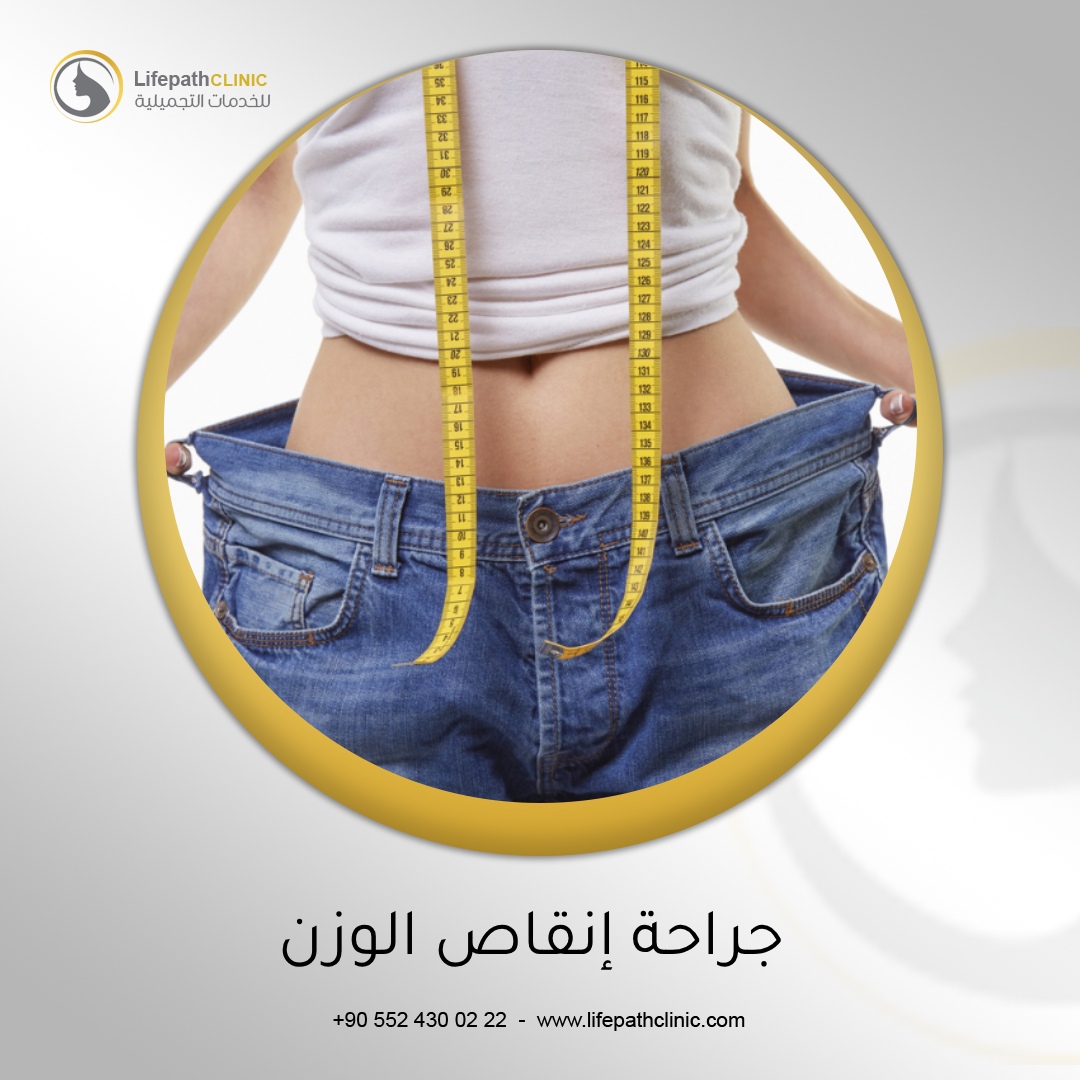 جراحة إنقاص الوزن: بين الحقيقة و الخرافة