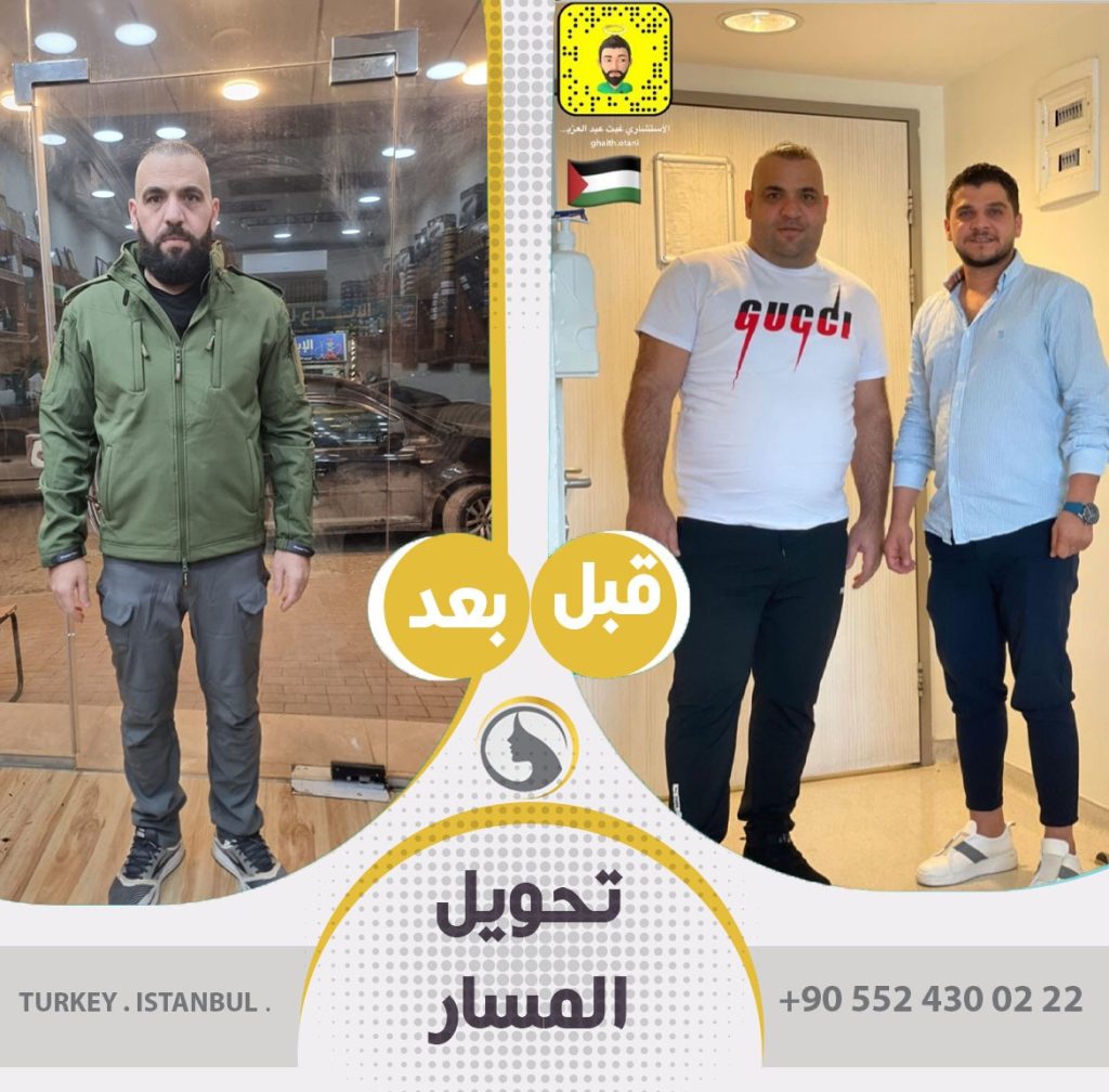 صور عملاء باث لايف كلينك قبل و بعد تحويل مسار المعدة