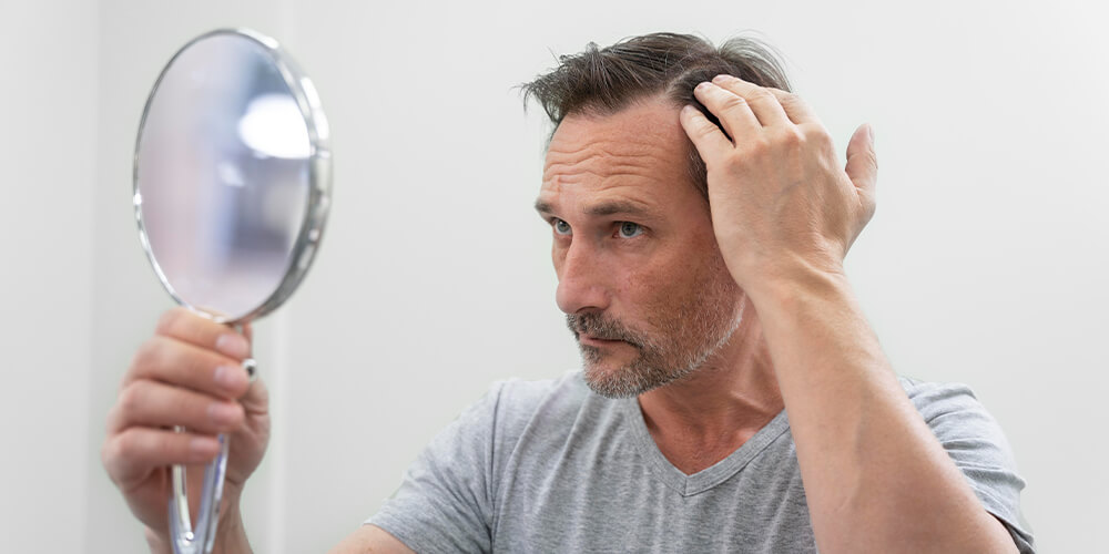 إجراء عملية زراعة الشعر: ما يمكن توقعه خلال الأسبوع الأول