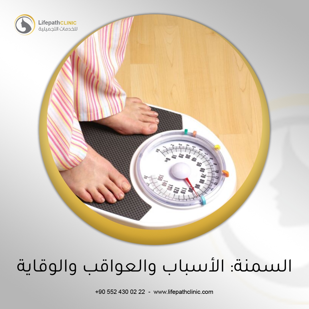 السمنة: الأسباب والعواقب والوقاية