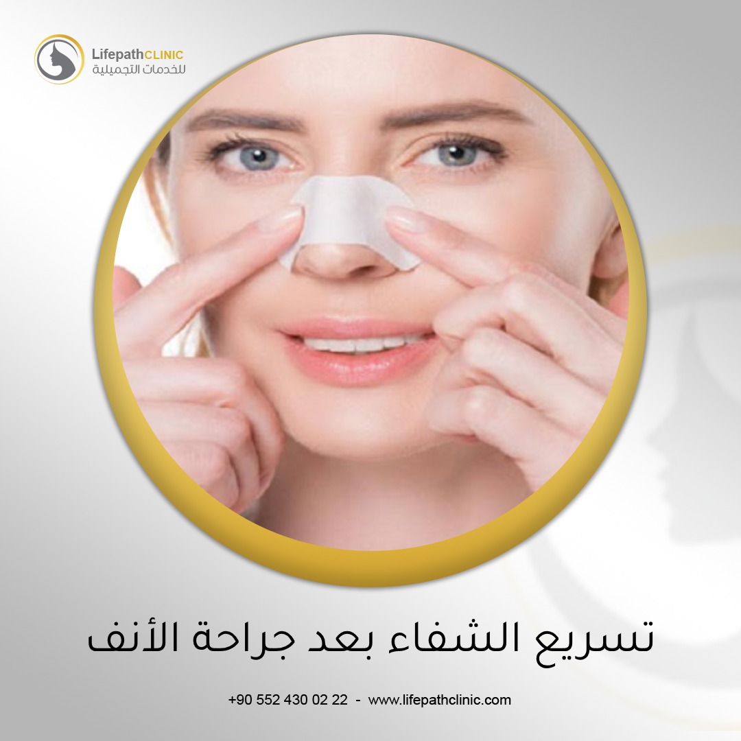 13 نصيحة لتسريع فترة الشفاء من عملية تجميل الأنف