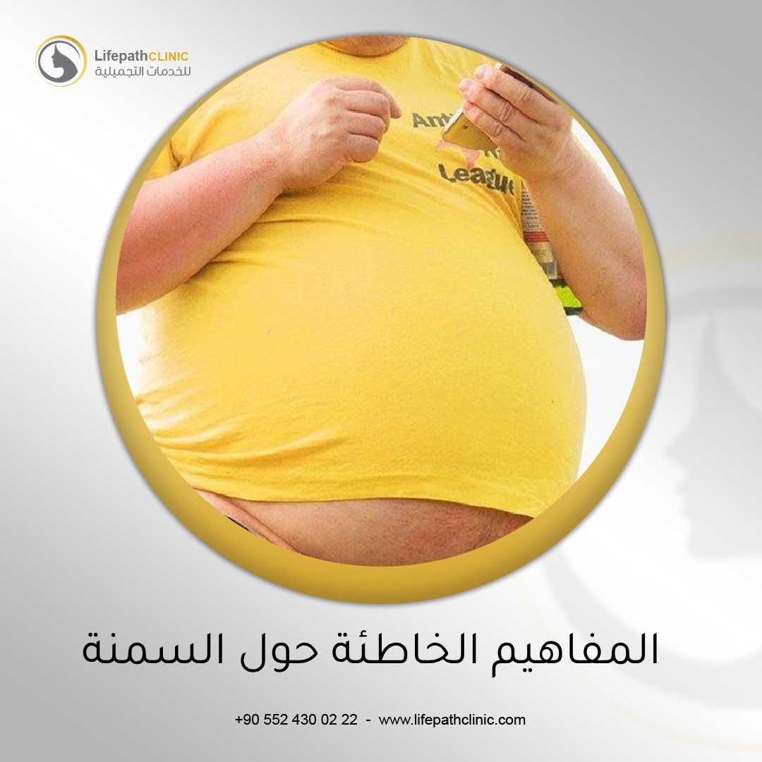 المفاهيم الخاطئة حول السمنة