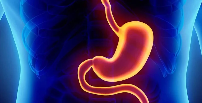 التسرب بعد جراحة تكميم المعدة: المخاطر و العلاج