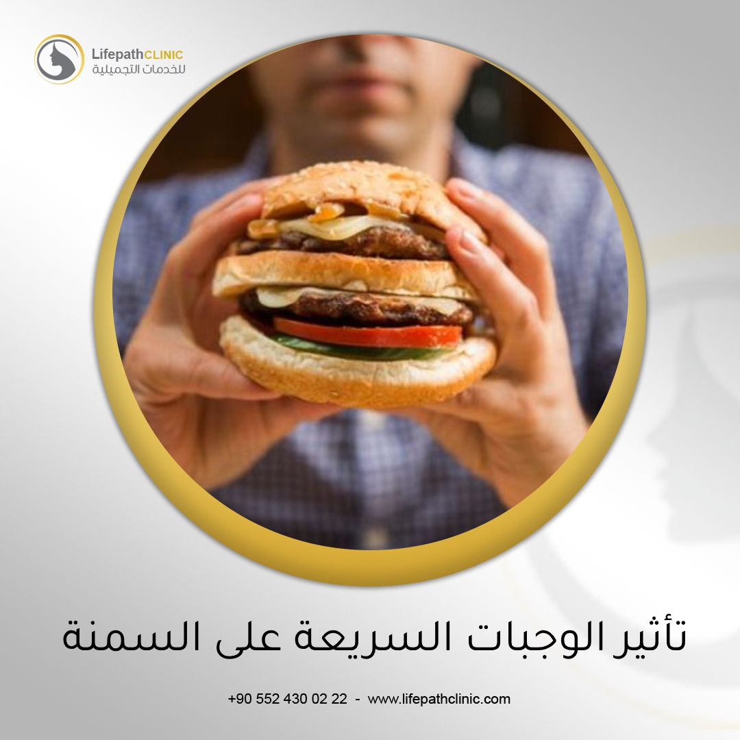 استراتيجيات مكافحة السمنة