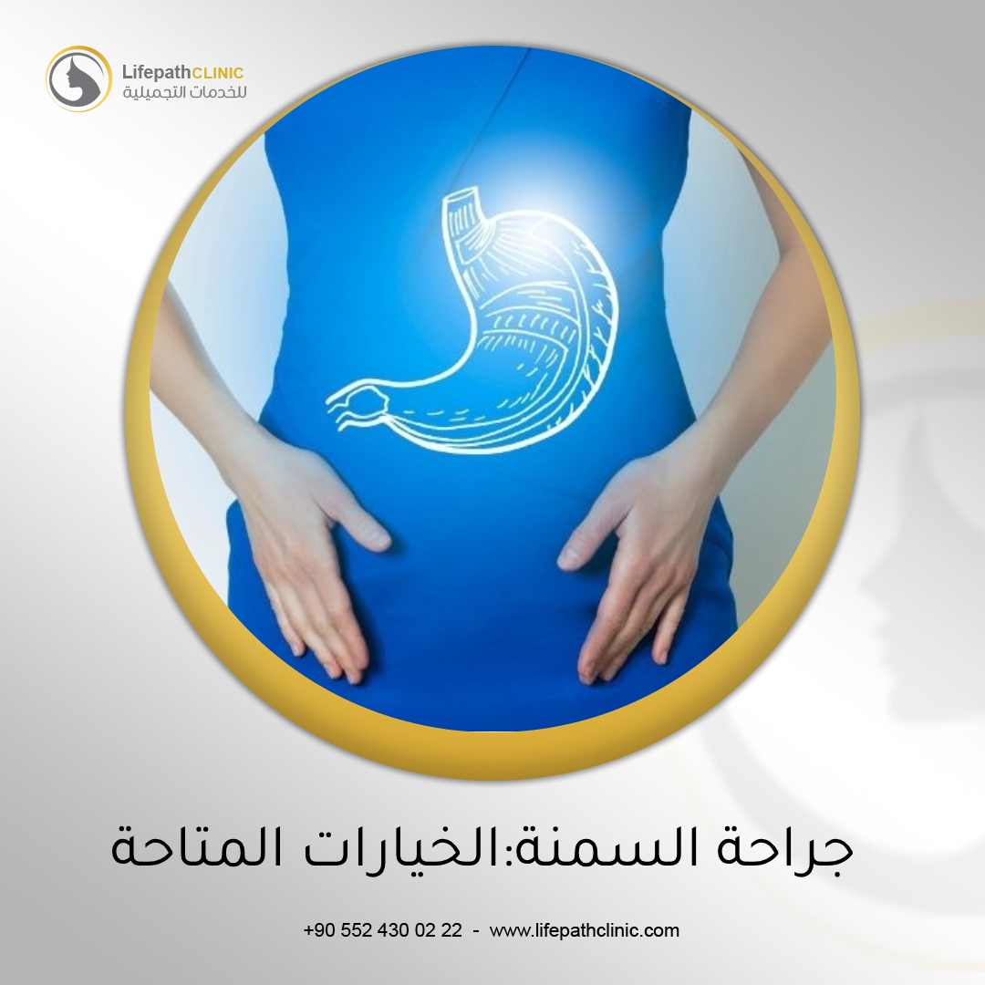 جراحة السمنة: استكشاف الخيارات المتاحة أمامك