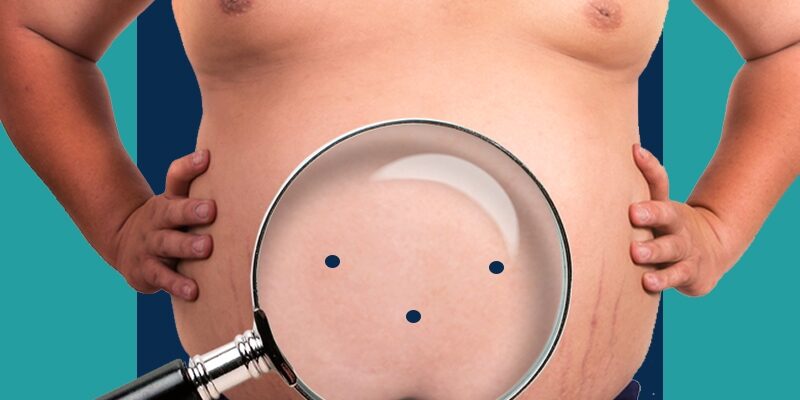 علاقة عملية تحويل مسار المعدة بتحسين النوم وتقليل الألم