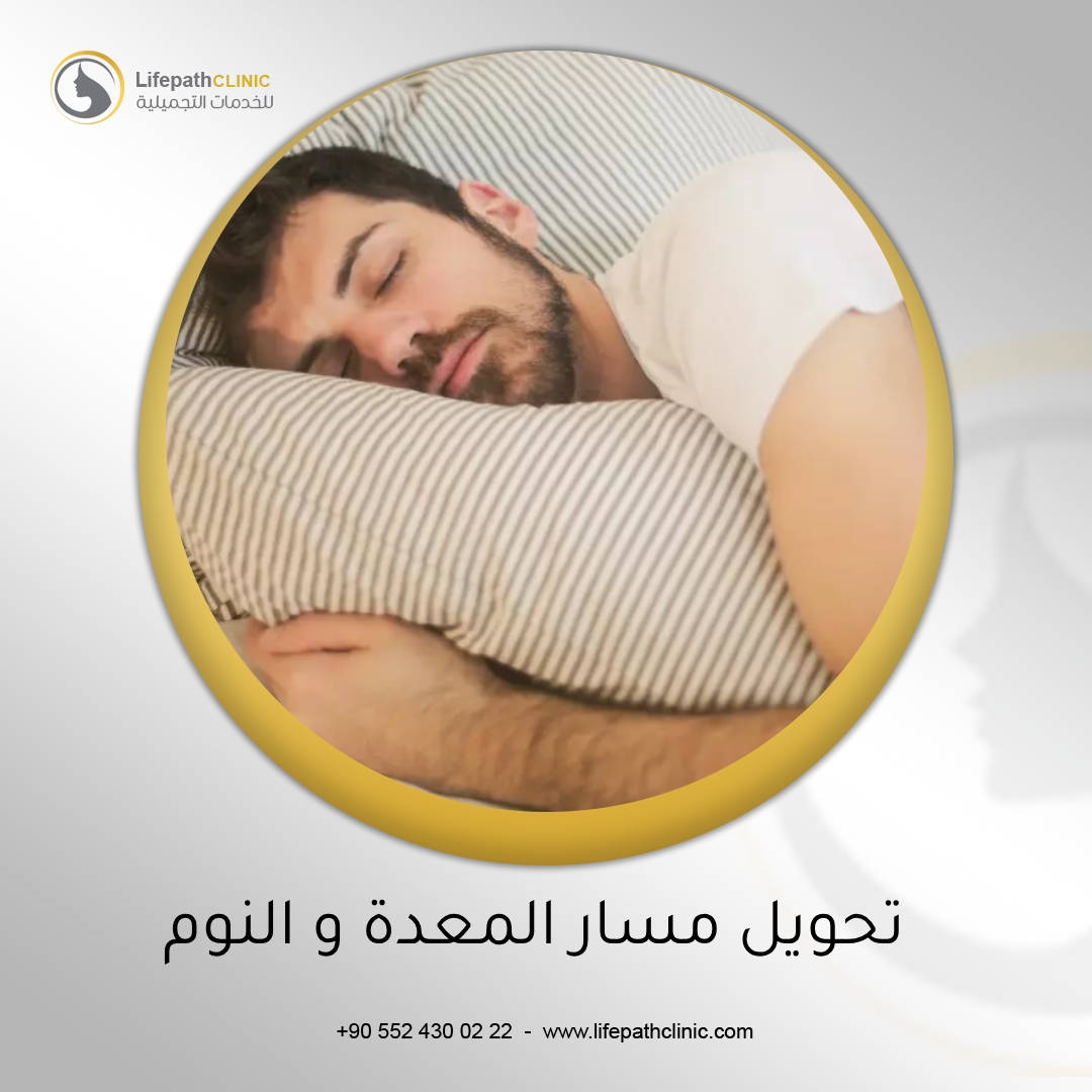 علاقة عملية تحويل مسار المعدة بتحسين النوم وتقليل الألم