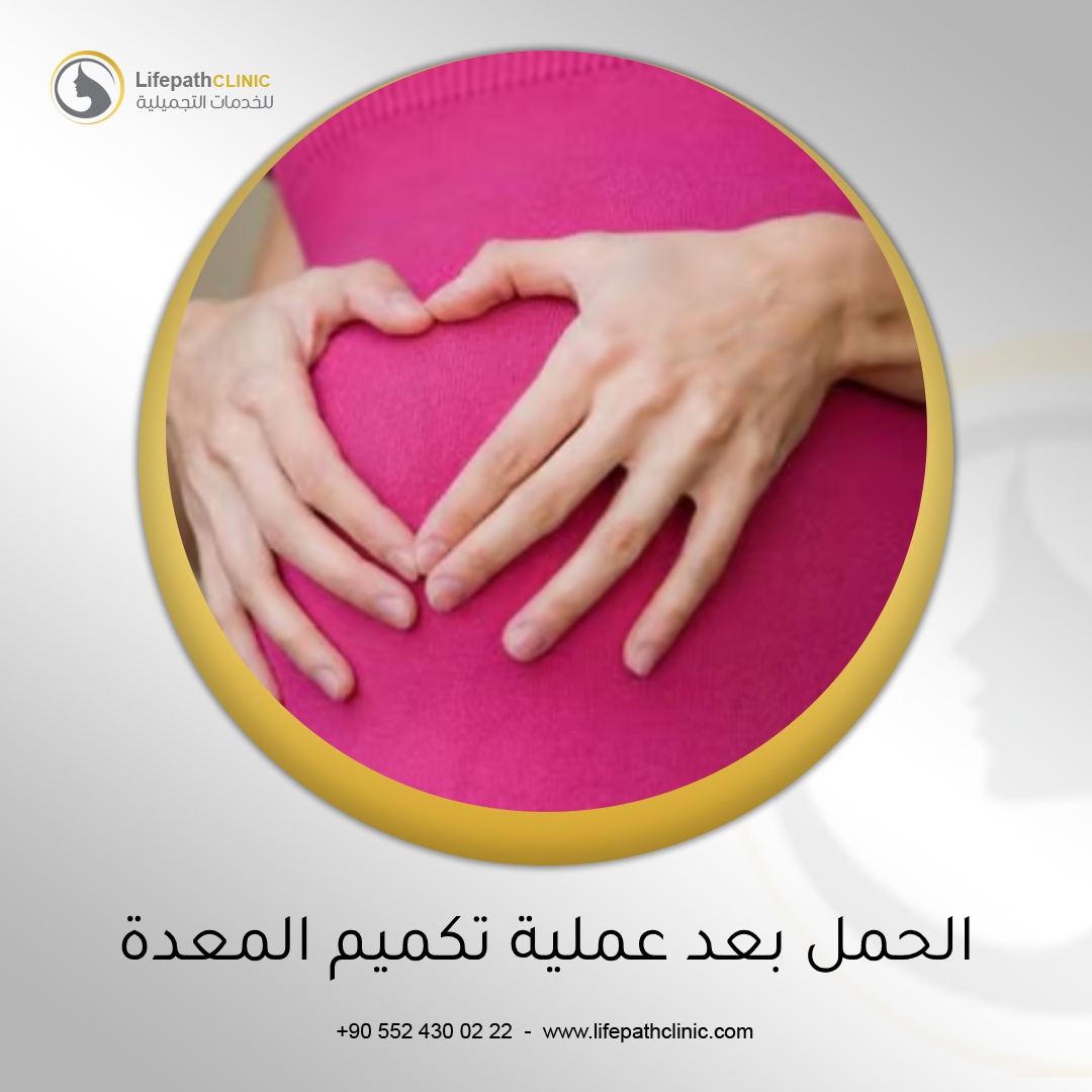 الحمل بعد عملية تكميم المعدة
