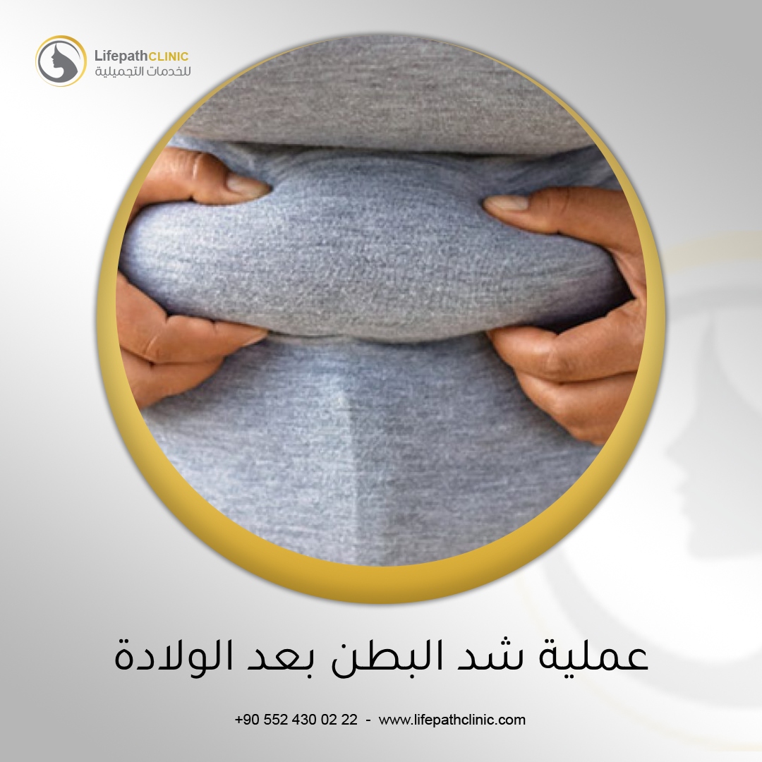 عملية شد البطن بعد الولادة