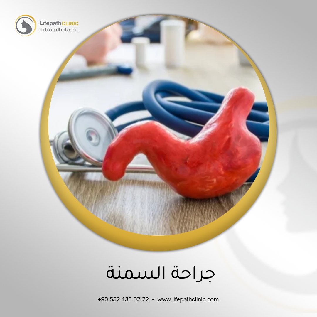 كل ما تحتاج معرفته عن جراحة السمنة