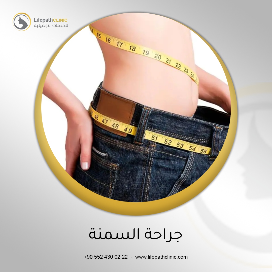 جراحة السمنة: هل هي الخيار المناسب لك؟