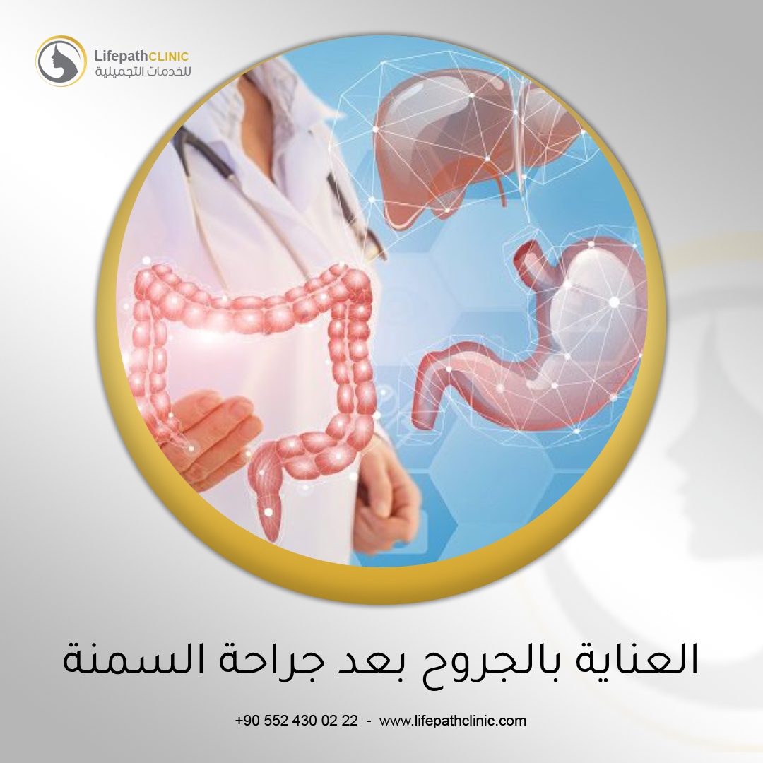 العناية بالجروح والندوب بعد جراحة السمنة