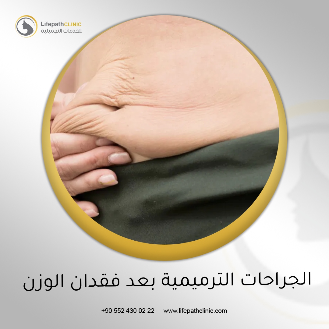 الجراحات الترميمية بعد فقدان الوزن الكبير