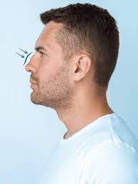 جراحة تجميل الأنف للرجال