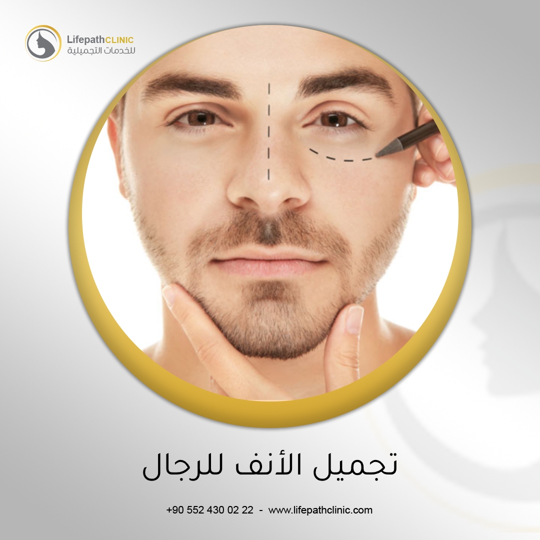 جراحة تجميل الأنف للرجال
