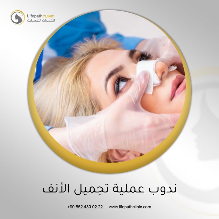 ندوب عملية تجميل الأنف