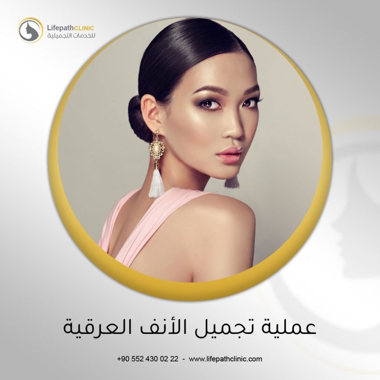 عملية تجميل الأنف العرقية