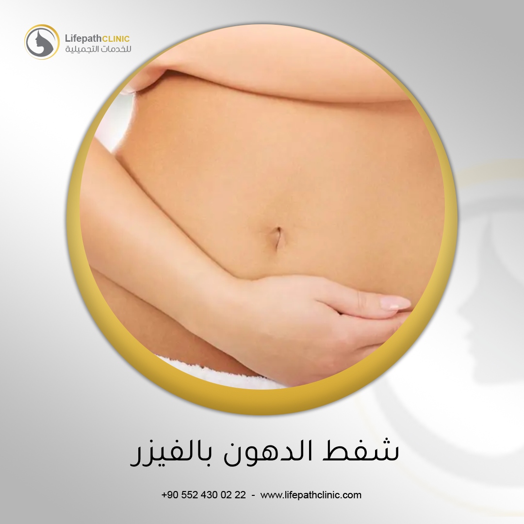 شفط الدهون بالفيزر